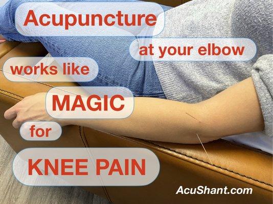 How can acupuncture at your elbow fix your knee pain?
 You gotta feel it to believe it! 
 Make your appointment