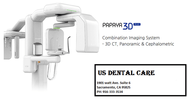 CBCT 3D Scan for $150