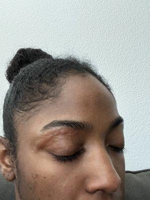 Waxed Eyebrows + waxed skin due to the wax being too hot. Imani's work