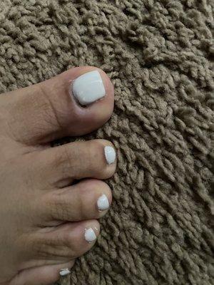 Horrible Shellac Pedicure