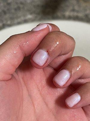 The cut on my cuticle AFTER washing the blood off. You can also clearly see how many layers of polish are on my nails.