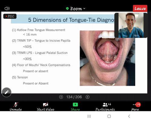 Tongue Tie Trivia