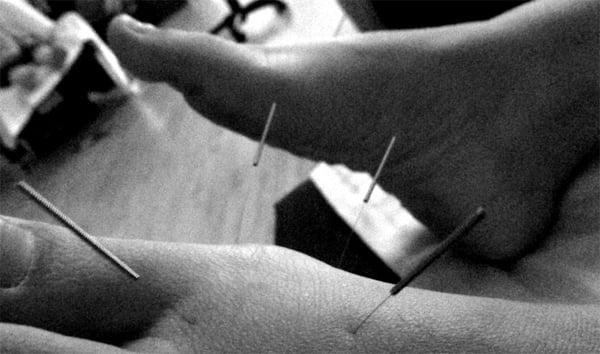 Hair thin needles.