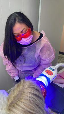 Teeth whitening