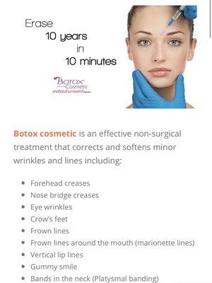 Call 410-644-7655 or visit www.sollaylasercenter.com to learn more about Botox and look younger today!