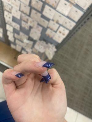 The cuts on my nails