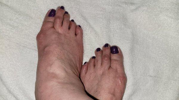 Pedi, my feet aren't pretty, but my toes look GREAT.