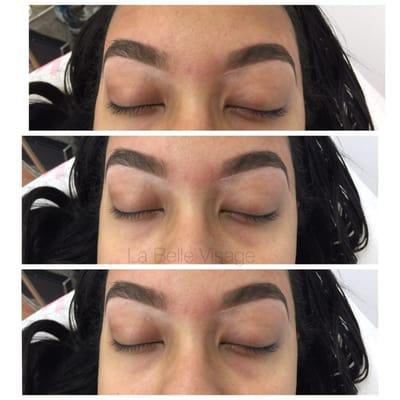 Brow shaping