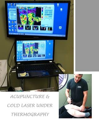 Cold laser and acupuncture under thermography