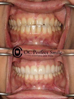 Gain confidence with a beautiful natural smile.