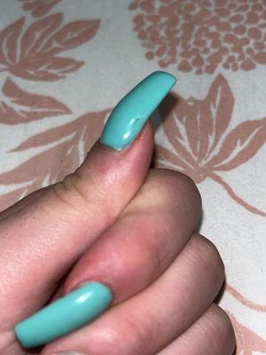 Nail cracked.