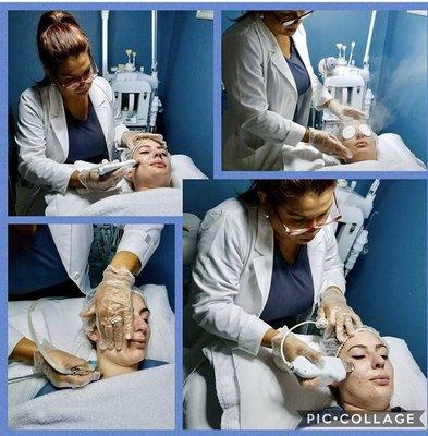 Microdermabrasion treatment