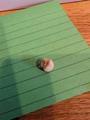 Human tooth found in the beef ramen