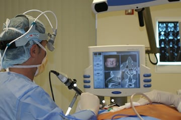 Endoscopic Sinus Surgery Brain Lab's Computerized Navigational System