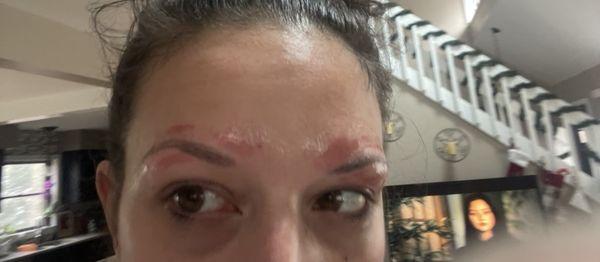 Ok. Queenie burnt my skin and eyebrows with their dirty wax on NYE!! And she knew. Read my review!