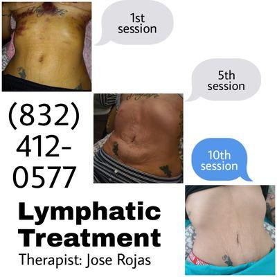 Lymphatic Treatments available! Please call for consultation.