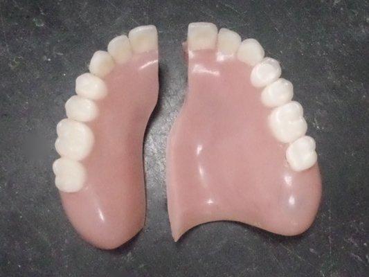 Repair dentures while you wait