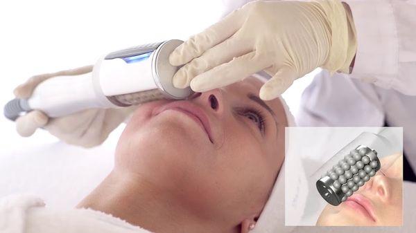 ENDOSPHERES THERAPY FOR FACE