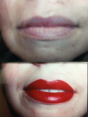 Full Lips... Before and After