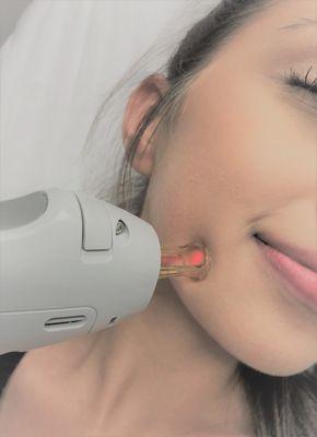 Laser skin treatments are available in addition to laser hair removal