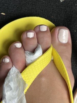 You can still see the old polish on the big toe, nails are all shaped different and what in the pinky, no words for that smh.