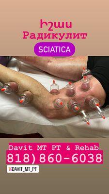 Cupping therapy