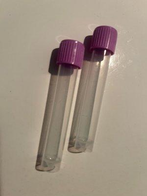 Empty vials that don't have the fluid needed