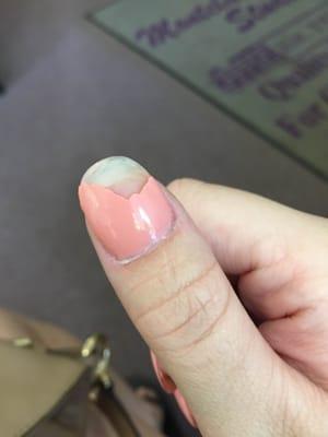 this is the other thumb which is way worse. WTF?!