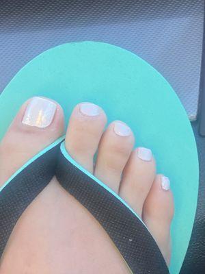 Look how slanted my toe nail is and how my cuticles are still over my nail bed.