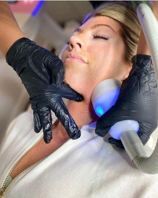 Cryoskin Facials are a powerful tool to use to maintain that youthful glow.