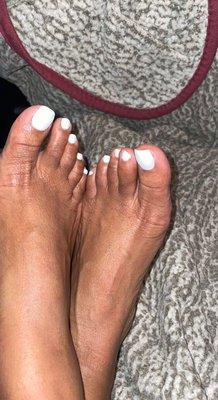 White gel toes