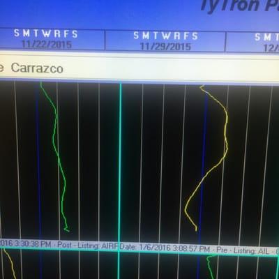 He does a scan pre and post adjustment! Right side is before adjustment, left is after ONE adjustment, look how much more aligned I am!!!