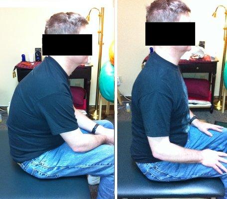 1 treatment he sits properly on his hip bones and backache and headache disappear.