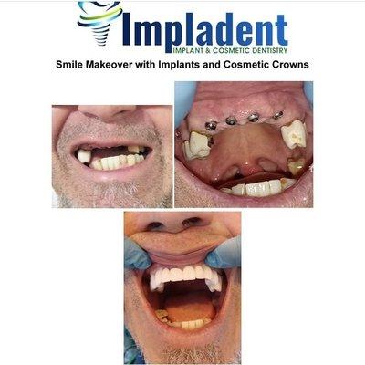 Impladent Implant & Cosmetic Dentistry Anaheim, CA