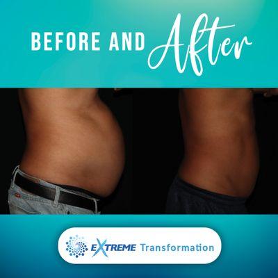 Extreme Transformation Program - Before and After