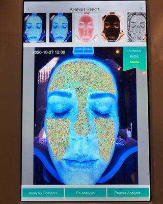 Optic Skin Analysis. We take a 3D Image of your skin to show you what is going on under the skin.