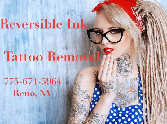 Reversible Ink Tattoo Removal