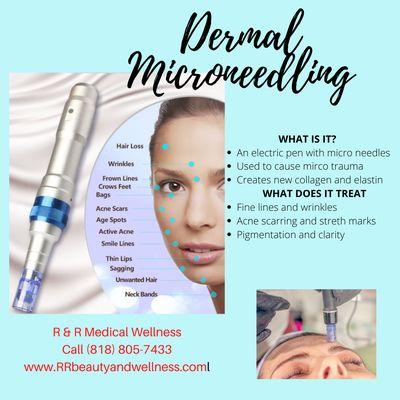 Dermal Microneedling