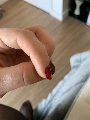 Another damaged nail