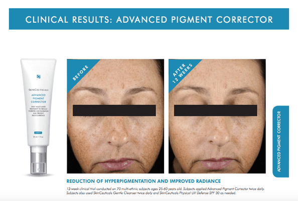 SkinCeuticals Advanced Pigment Corrector