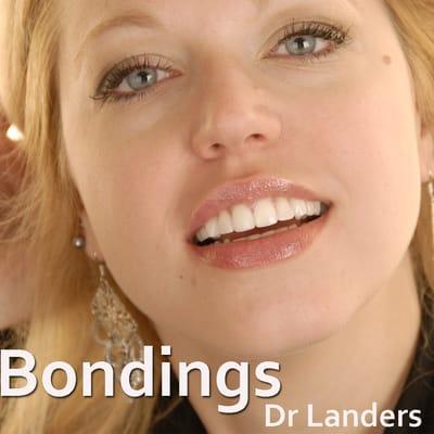 Dental Bondings & Tooth Reshaping Completed By Dr Kevin Landers