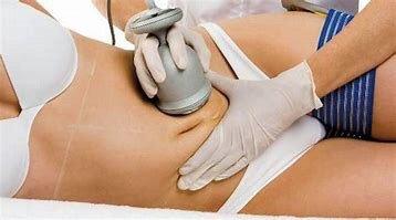 Cavitation is proven treatment to reduce inches even on the first visit