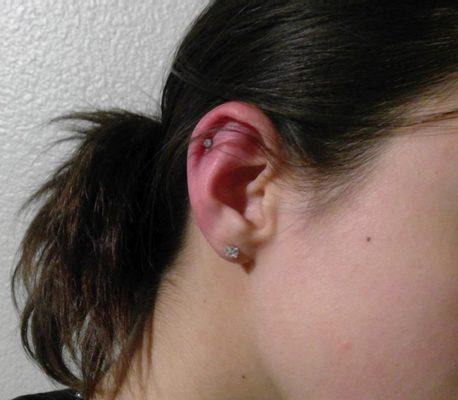 Cartilage Piercing. Just a little red from just having it done.