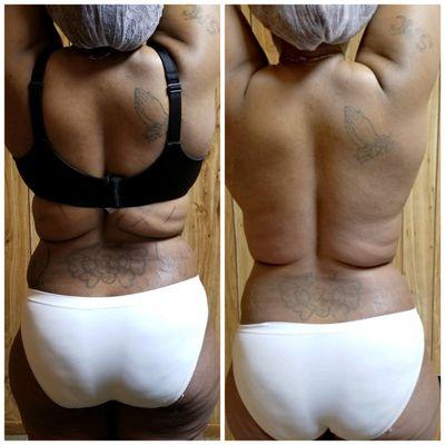 Before and After 1 session Back Saddlebags