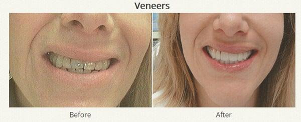 http://www.garnerdental.com/restorative-dentistry/