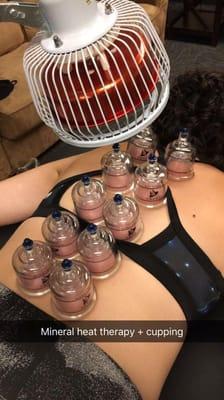 Heat and cupping therapy.