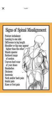 Signs of misalignment