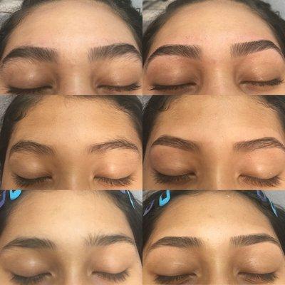 Eyebrows- before and after pictures