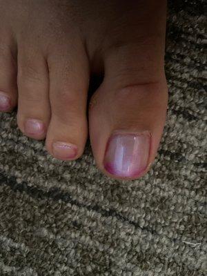 Entire toe was initially the bright pink color.  The color gradually faded away.