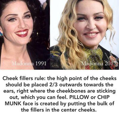 Beware of puffy cheeks. We follow the golden ratio to create perfect, sensational looking cheeks.